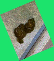 thumbnail of uz7KKHAKY.jpg