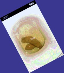 thumbnail of 6VECW3p.jpg