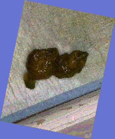 thumbnail of R2cVSXY.jpg