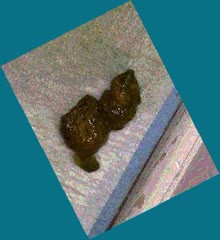 thumbnail of cMhyfhVKOZMuoRhesjq.jpg