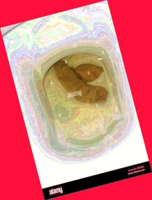 thumbnail of LqMlNnICQl.jpg