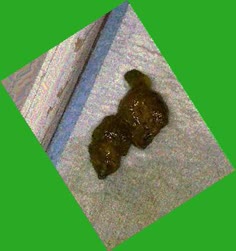 thumbnail of Jyp6eqSM06LTwfq.jpg