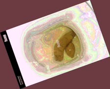 thumbnail of 0Apa9vYUjNNxygkb.jpg