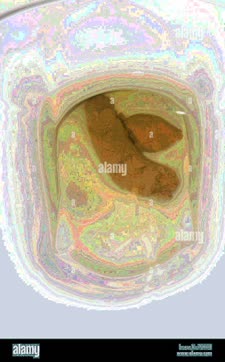 thumbnail of xPsC2j.jpg