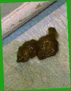 thumbnail of 7LBI9w.jpg