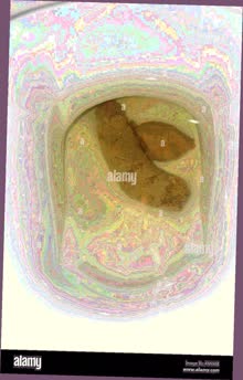 thumbnail of NmuBdnPTEc8T.jpg